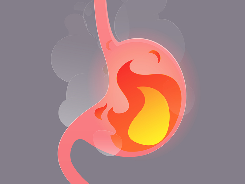 Você sabe a diferença entre gastrite e úlcera?